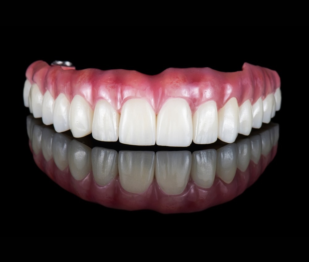 A full arch dental prosthesis with lifelike teeth and gums, photographed against a black background